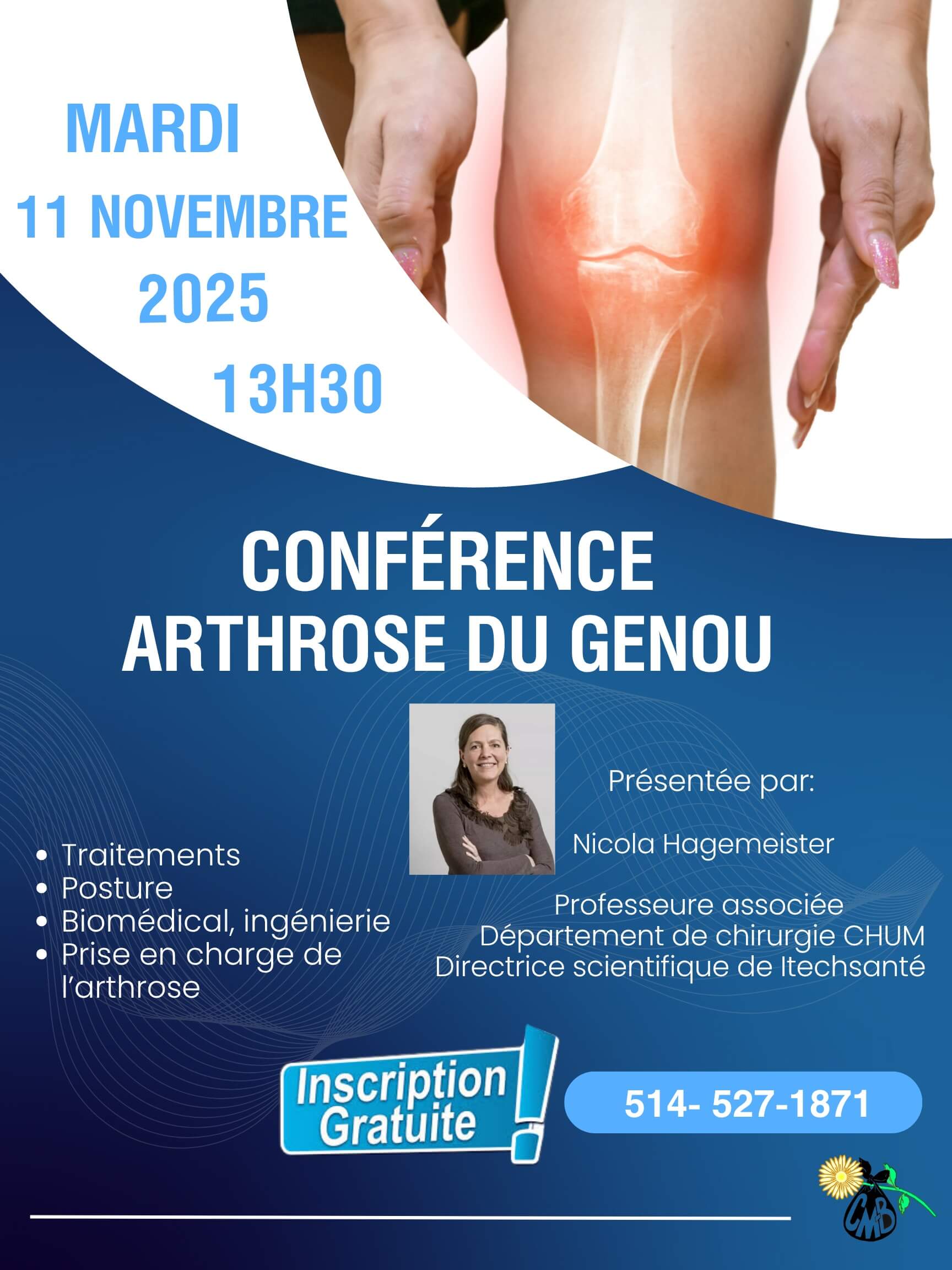 Image de l'article Le point sur l’ Arthrose du genou